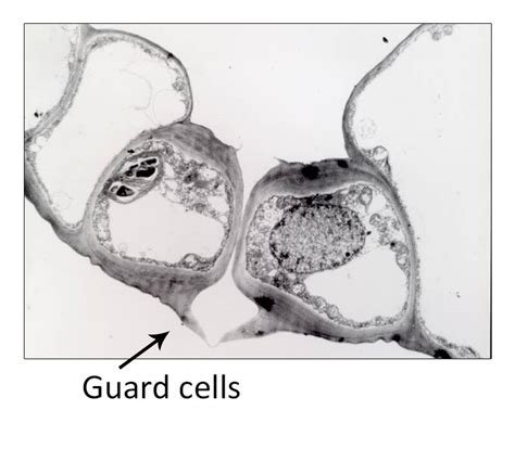 Image result for Guard Cell Structure Micrograph