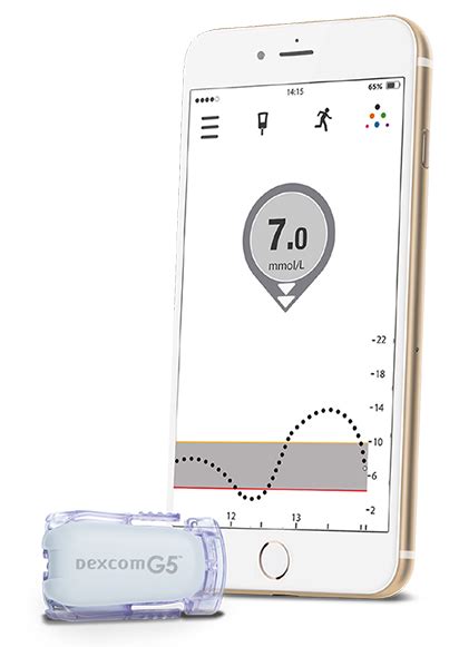 Toradh íomhá ar Dexcom G5 Sensor