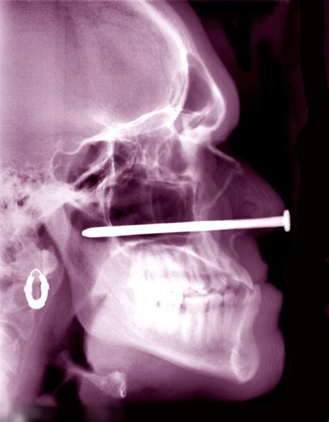 Image result for Block Head Human