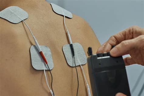 Transcutaneous Electrical Stimulation-এর ছবি ফলাফল