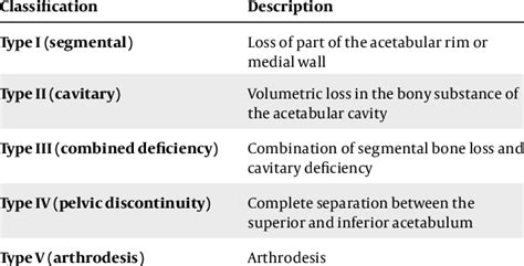 Afbeeldingsresultaten voor AAOS Acetabular Defect Classification