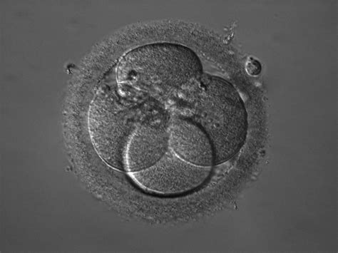 Image result for Human Embryo Electron Microscope