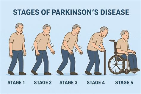 Image result for Sequence Diagram for Parkinson Disease