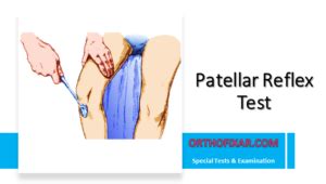 Image result for Patellar Compression Test