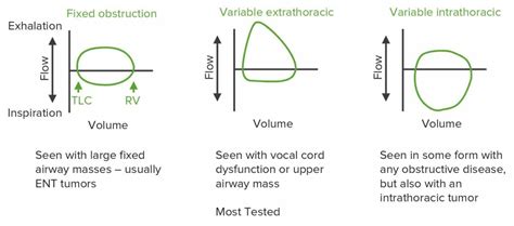 Image result for Pulmonary Function Test Flow Loop