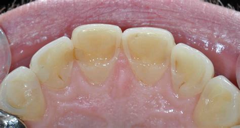 Restricted Envelope of Function に対する画像結果