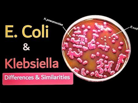 Image result for E. Coli Fermentor