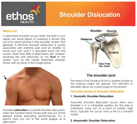 Toradh íomhá ar Dislocation Drawing
