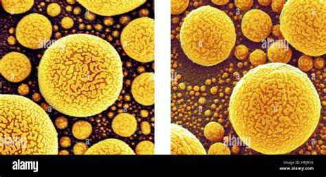 Atom Microscope に対する画像結果