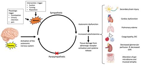 Toradh íomhá ar Autonomic Dysfunction