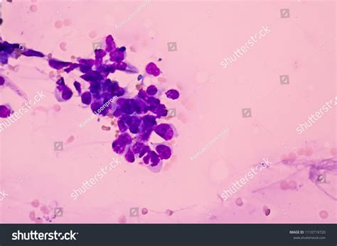 Diff Quick Stain Procedure に対する画像結果