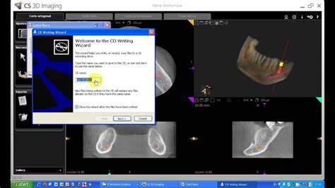 Image result for Carestream 3D Imaging Software