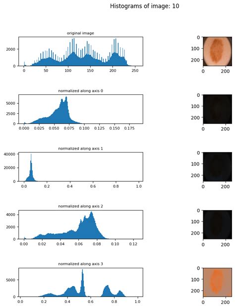 Image result for Image Normalization