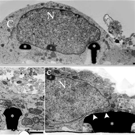 Neuron Electronic Microscope に対する画像結果