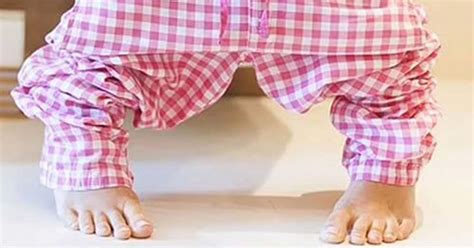 Your Stool Shape Could Be a Symptom of Colon Cancer, Doctors Warn