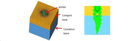 Image result for Finite-Element Computer