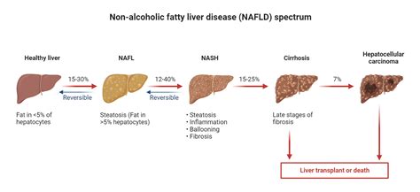 Afbeeldingsresultaten voor Insulin Algorithm Type 2 Diabetes