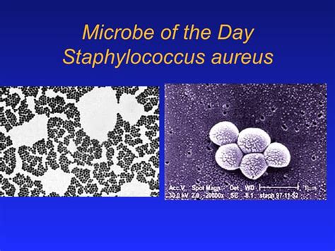 Afbeeldingsresultaten voor Stracture Text Extension vs Code Formating