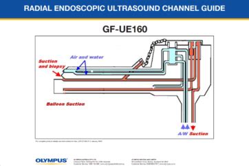 Toradh íomhá ar JavaScript Scope Diagrams