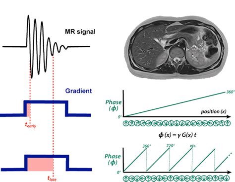 Image result for MRI Gradient Distribution Plot