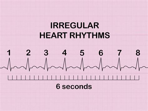 Image result for Normal Heart Rate On an ECG