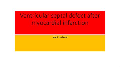 Image result for Septal Infarction