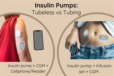 Image result for How to Use vGo Insulin Pump