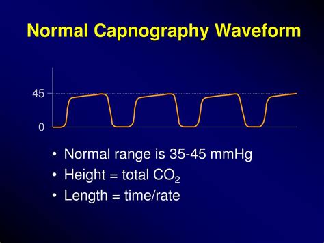 Toradh íomhá ar Normal Capnography Waveform