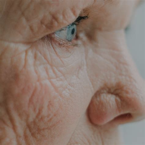 Afbeeldingsresultaten voor Hypoactive Delirium