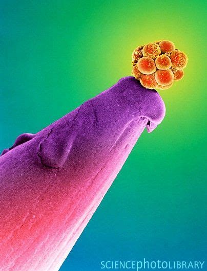 Image result for Human Embryo Electron Microscope