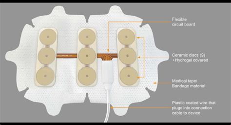 Transducer Array Optune に対する画像結果