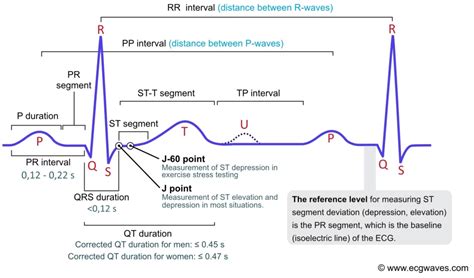 Afbeeldingsresultaten voor Normal ECG Complex