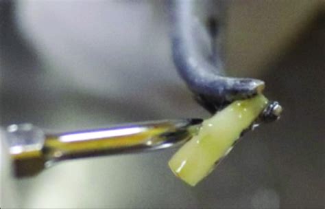 Image result for Ultrasonic Scaling