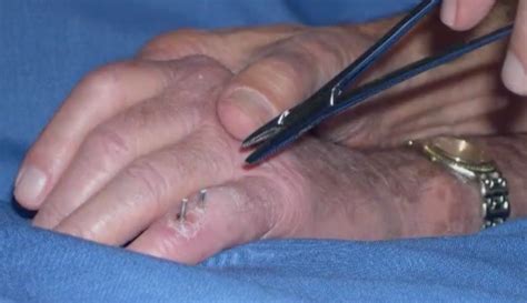 Toradh íomhá ar Digit Widget Finger