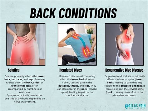 Back Pain From Lifting Overhead に対する画像結果