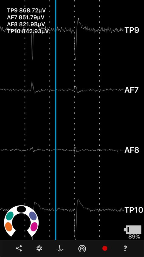 Image result for Entropy Brain Monitor
