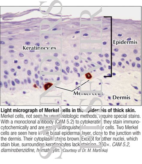 Afbeeldingsresultaten voor Merkel Cell Light Microscopy