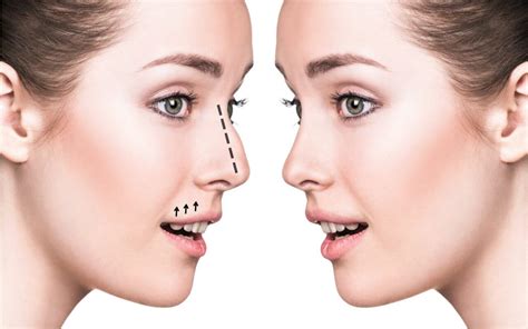 Image result for How to Get Your Nose Perfect with Hands