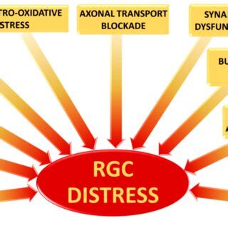 Image result for Complement Cascade Pathway