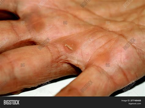 Finger Calluses に対する画像結果