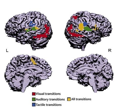 Visual Cortex Activation Map Surface に対する画像結果
