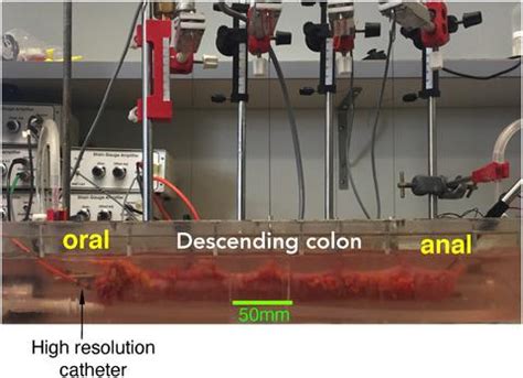 Image result for High Resolution Colonic Manometry Drawing