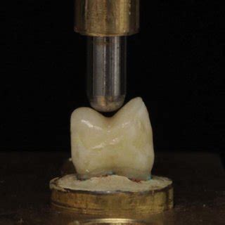 Image result for Root Fracture Universal Testing Machine