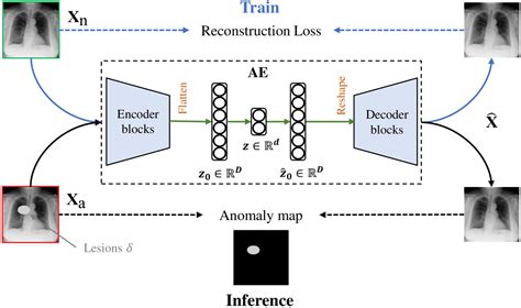 Image result for Autoencoder Medical Image Label Generation