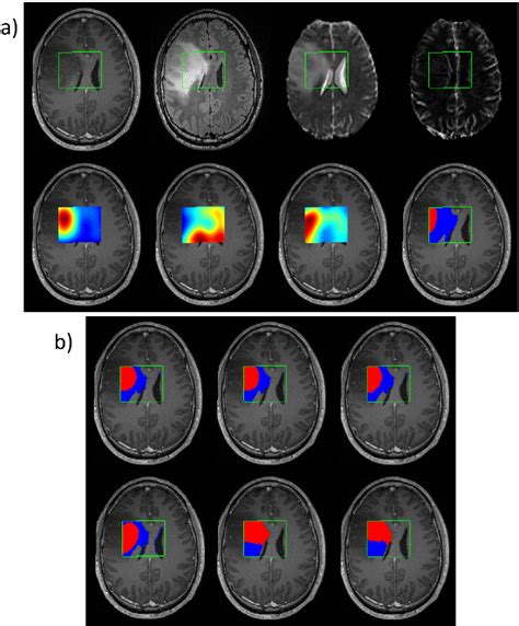 Toradh íomhá ar Unsupervised Classification Methods Comparison