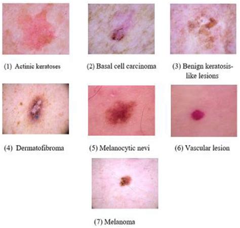 Toradh íomhá ar Image Classification Using Deep Learning Block Diagram