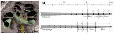 Image result for Split Electrode Array