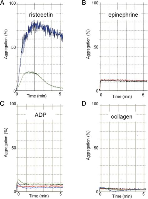 Toradh íomhá ar Normal Platelet Aggregation Graph