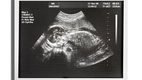 Image result for ultrasound medical imaging