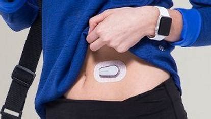 Dexcom G6 Continuous Glucose Monitor (CGM) | Dexcom
